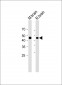 PTEN antibody